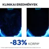 URIAGE DS HAIR Lotion spray korpás fejbőrre (100ml) 