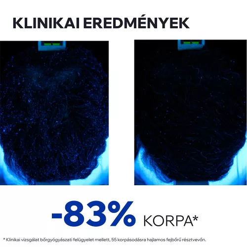 URIAGE DS HAIR Lotion spray korpás fejbőrre (100ml) 