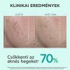 APIVITA BEE Tech just Bee clear szérum bőrhibák el 30ml