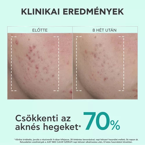 APIVITA BEE Tech just Bee clear szérum bőrhibák el 30ml