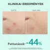 APIVITA BEE Tech just Bee clear szérum bőrhibák el 30ml
