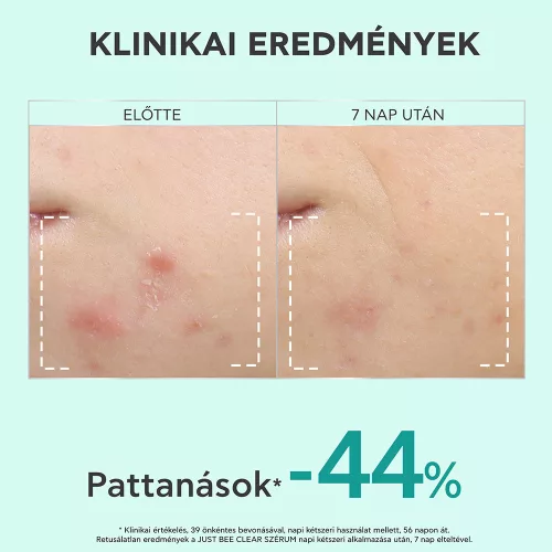 APIVITA BEE Tech just Bee clear szérum bőrhibák el 30ml