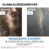 URIAGE D.S. Hair sampon korpás fejbőrre (200ml) 