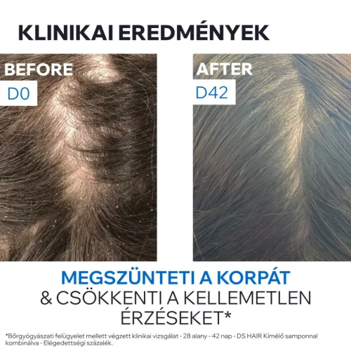 URIAGE D.S. Hair sampon korpás fejbőrre (200ml) 