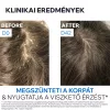URIAGE D.S. Hair intenzív sampon erősen korpás fejbőrre (150ml) 