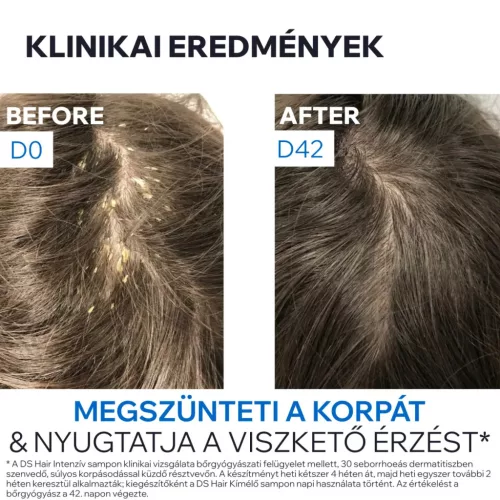 URIAGE D.S. Hair intenzív sampon erősen korpás fejbőrre (150ml) 
