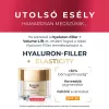EUCERIN Hyaluron-Filler + Volume-Lift arckrém száraz bőrre (50ml)  