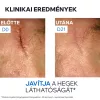 URIAGE Bariéderm-Cica Cu-Zn sebkezelő krém (15ml)