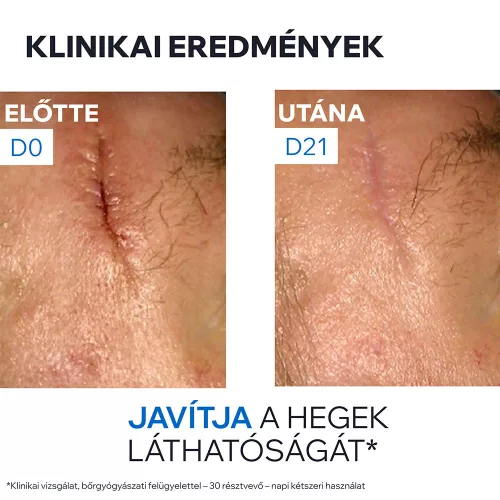 URIAGE Bariéderm-Cica Cu-Zn sebkezelő krém (15ml)