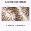 APIVITA Sampon száraz korpa ellen UTÁNTÖLTŐ (500ml)