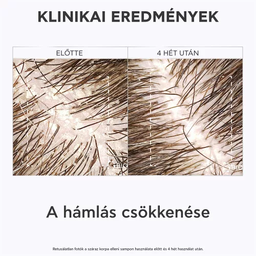 APIVITA Sampon száraz korpa ellen UTÁNTÖLTŐ (500ml)