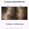 APIVITA Sampon száraz korpa ellen UTÁNTÖLTŐ (500ml)