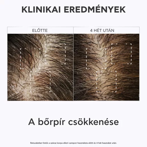 APIVITA Sampon száraz korpa ellen UTÁNTÖLTŐ (500ml)