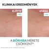 URIAGE Hyséac szárító gél pattanások SOS kezelésére (15ml)