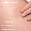 URIAGE Bariéderm bőrgyógyászati olaj striák ellen (100ml)