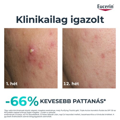 EUCERIN DermoPure Clinical Triple Action - Korrektív Fluid (40ml)