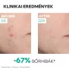 URIAGE Hyséac NEW SKIN Booster szérum (30ml)
