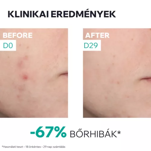 URIAGE Hyséac NEW SKIN Booster szérum (30ml)