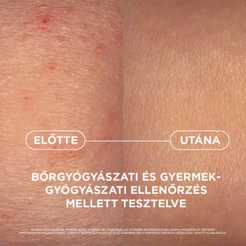 BIODERMA Atoderm AD Intensive balzsam (400ml)