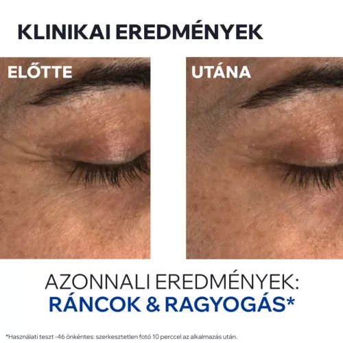 URIAGE Age Absolu bőrtömörséget fokozó ránctalanító szemkörnyékápoló (15ml)