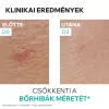 URIAGE Hyséac SOS paszta pattanásokra (15g)