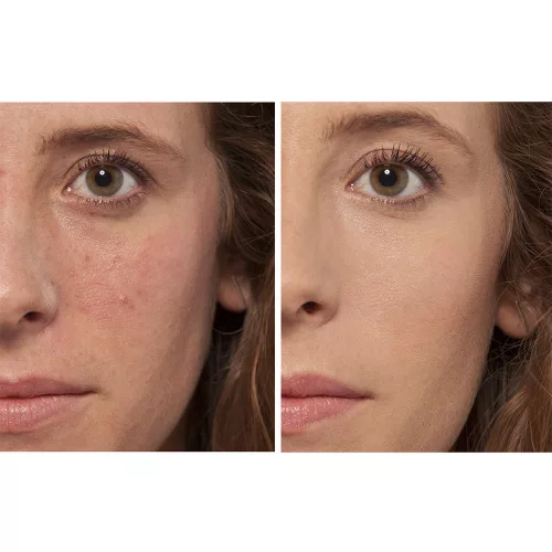 L'ORÉAL PARIS True Match The One folyékony korrektor 1R/C Rose Ivory (6,8ml)