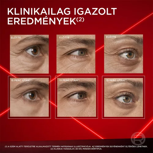 L'OREAL PARIS Revitalift Laser szem alatti táskákra 15ml