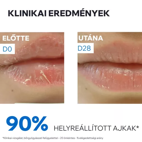 URIAGE Bariéderm-Cica ajakápoló balzsam (15g) 