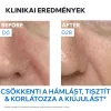 URIAGE D.S. Emulzió krém seborrhoeás bőrre (40ml)