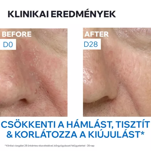 URIAGE D.S. Emulzió krém seborrhoeás bőrre (40ml)