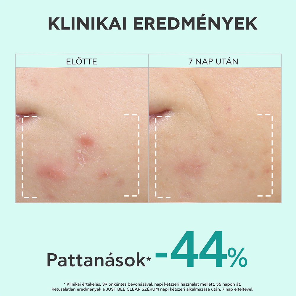 APIVITA BEE Tech just Bee clear szérum bőrhibák el 30ml